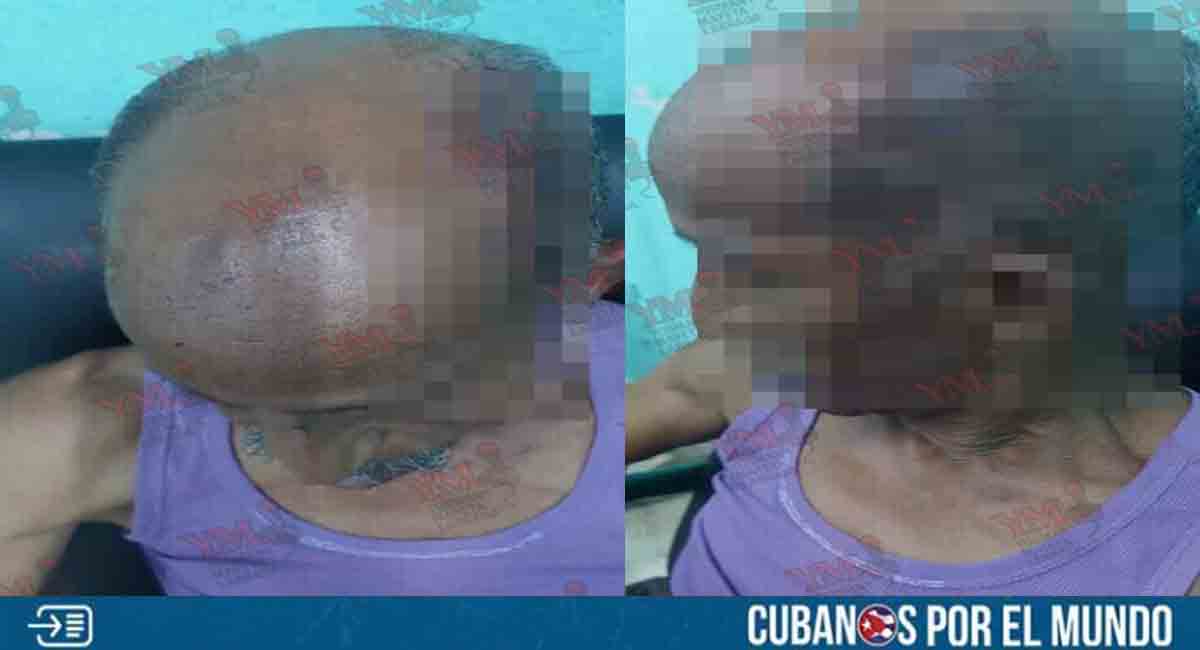 Reportan brutal agresión de un policía a un anciano en Santiago de Cuba