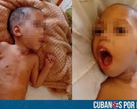 Ciego de Ávila: Niño en alarmante estado de salud necesita ayuda urgente