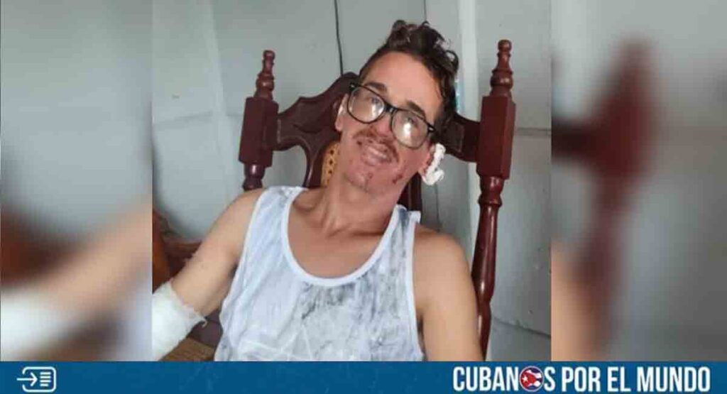 Se recupera uno de los heridos de la explosión en las parrandas de Guayos