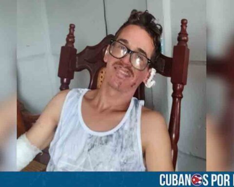 Se recupera uno de los heridos de la explosión en las parrandas de Guayos